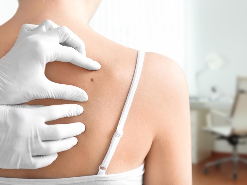 Kožní oddělení - všeobecná ambulance - Oblastní nemocnice Kladno